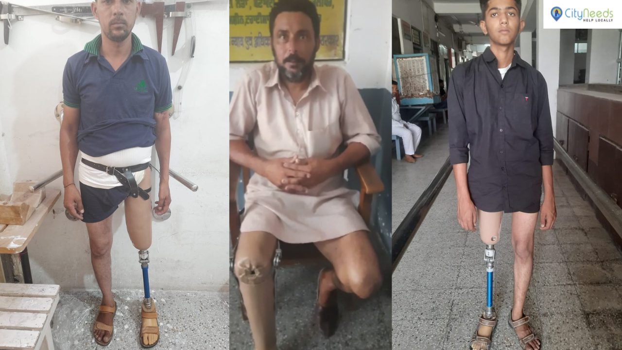 Artificial Limbs for Differently Abled