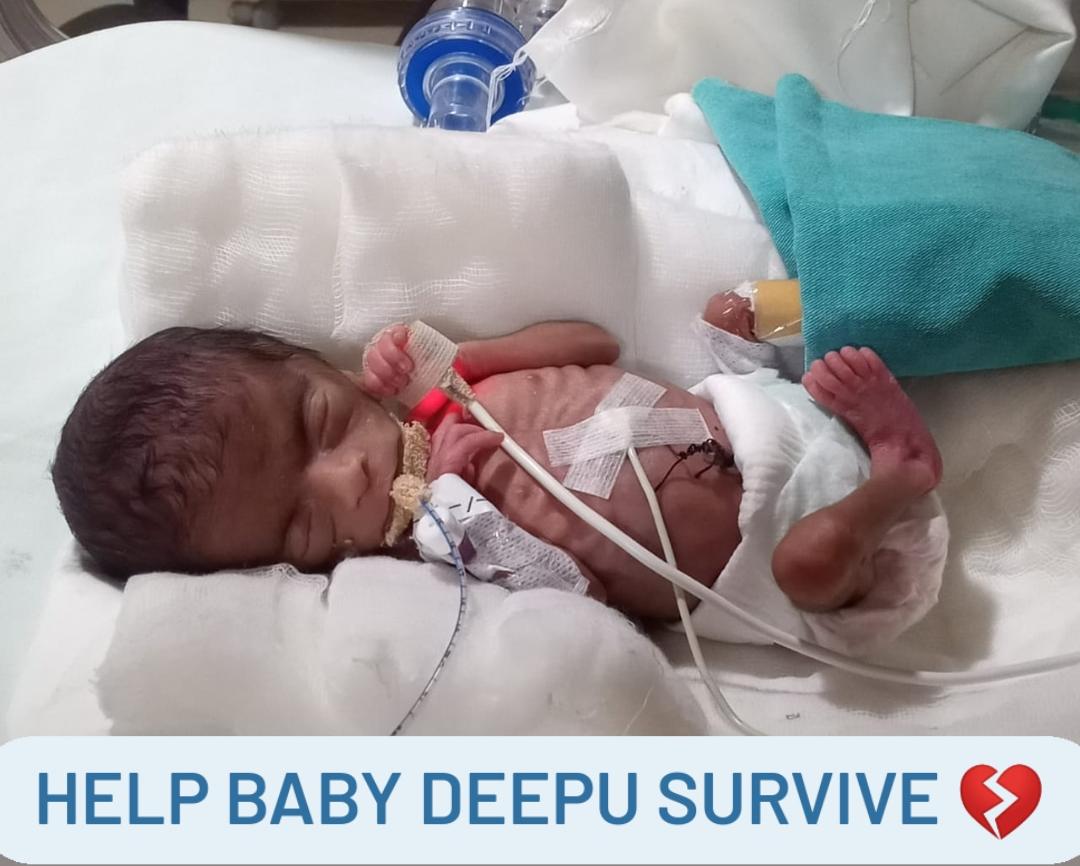 Help Baby Deepu Survive