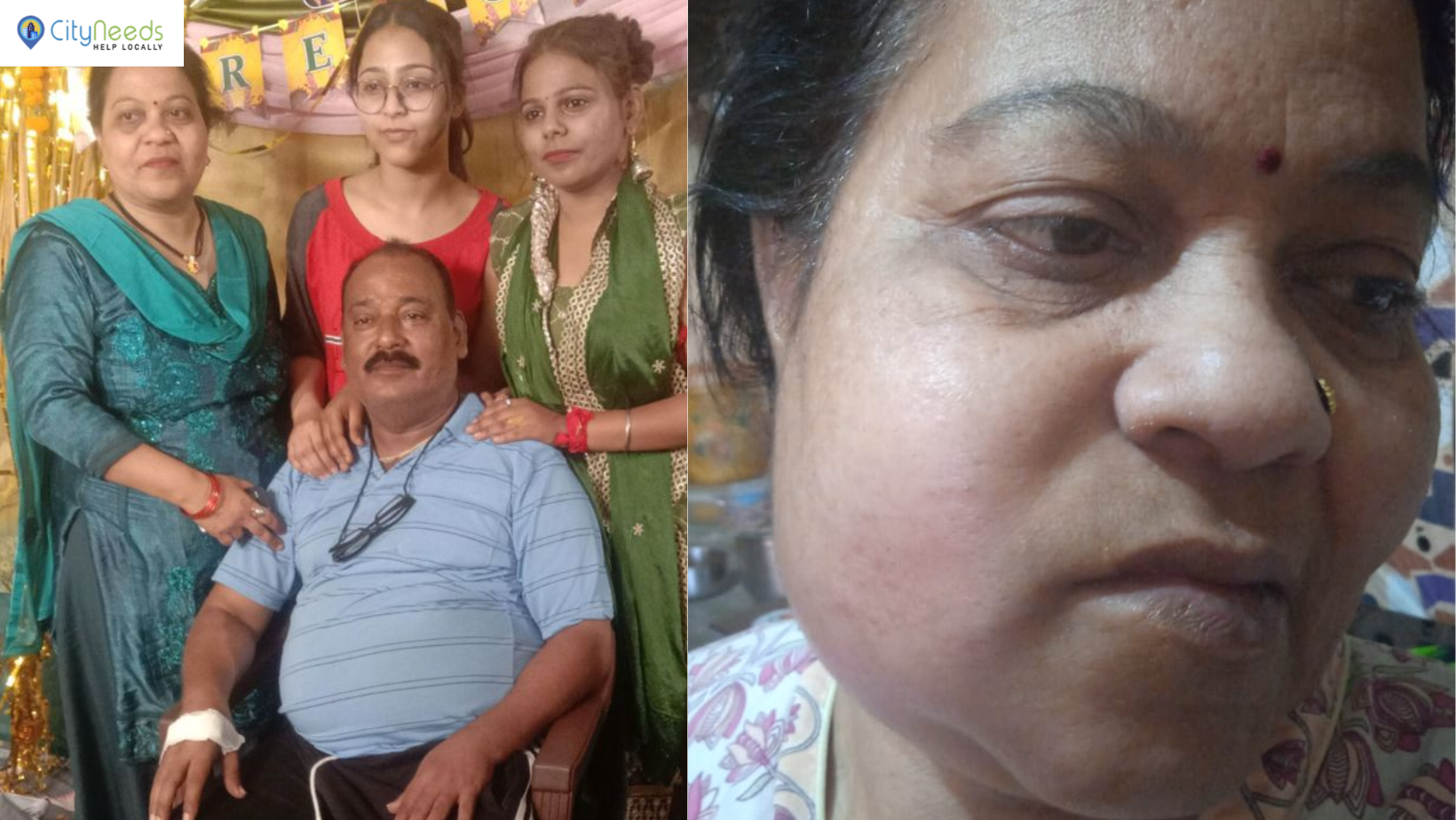 Help Charu Mishra Fight Oral Cancer