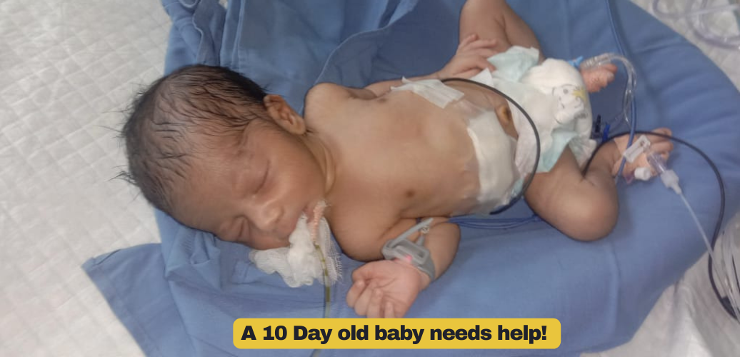 A 10 Day old baby needs help!